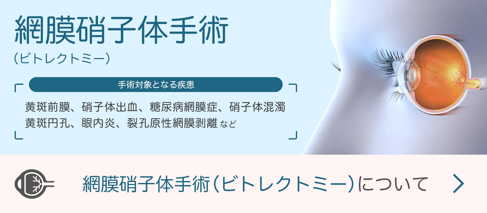 お知らせバナー